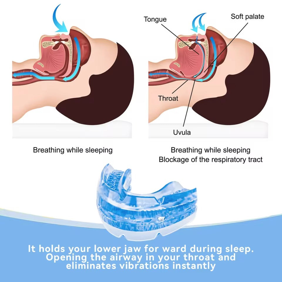 (VIP) Stellory® Adjustable Anti-Snore Mouthpiece