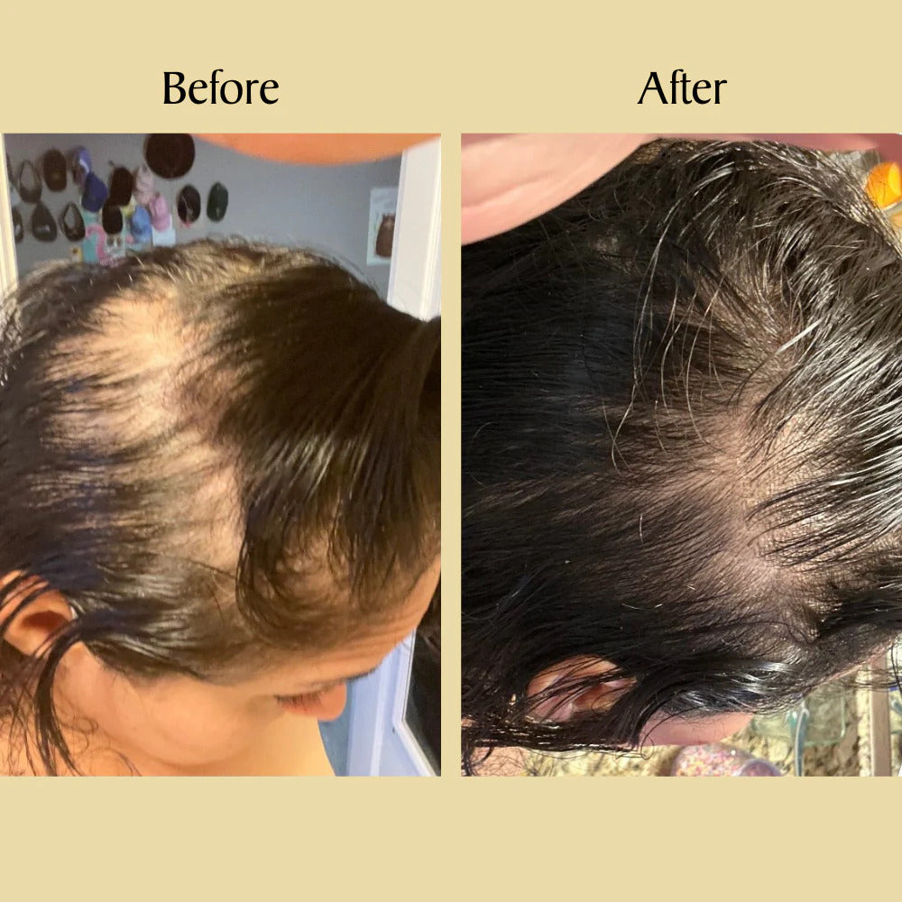 Stellory® Natural Hair Growth Oil