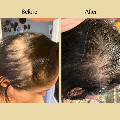 Stellory® Natural Hair Growth Oil