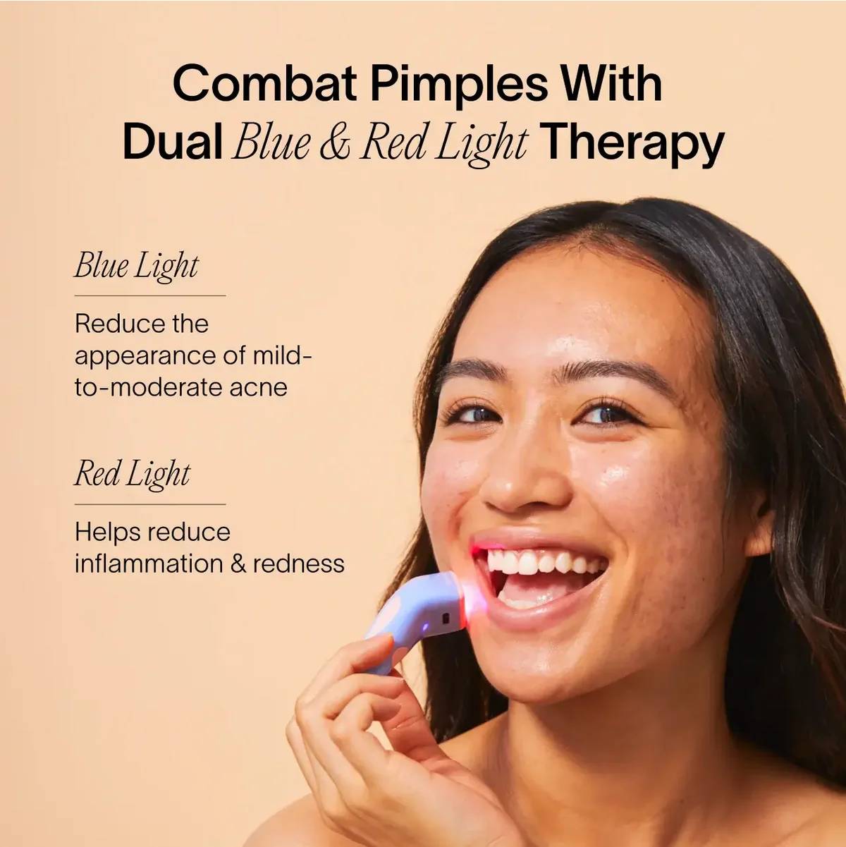(VIP) Stellory® 3-Minute Acne Spot Treatment