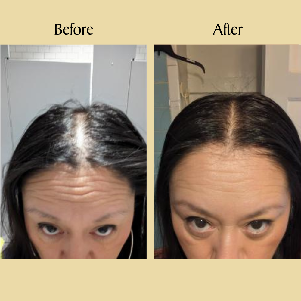 Stellory® Natural Hair Growth Oil