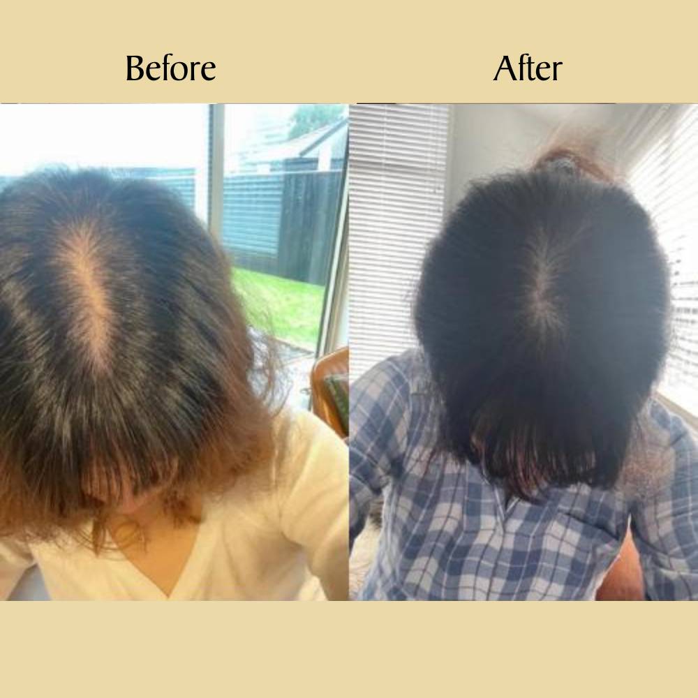 Stellory® Natural Hair Growth Oil