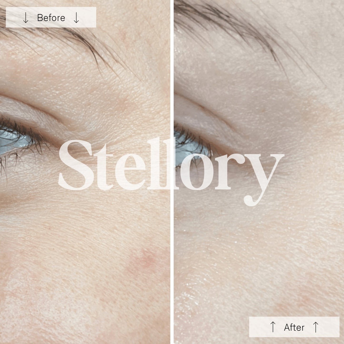 (VIP) Stellory® Red Light Therapy Mask - Rejuvenate Your Skin