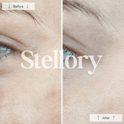 (VIP) Stellory® Red Light Therapy Mask - Rejuvenate Your Skin