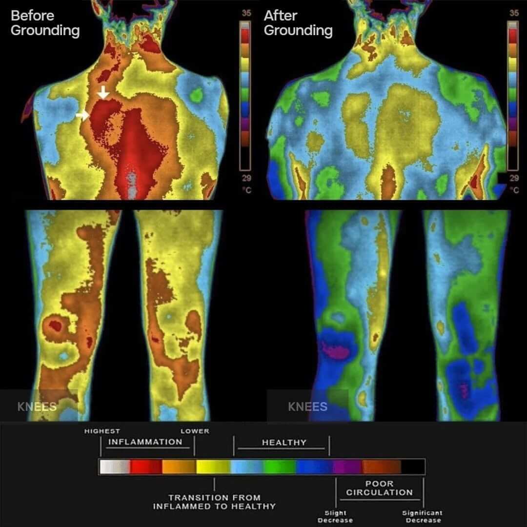 StelloryMD Grounding Sheet