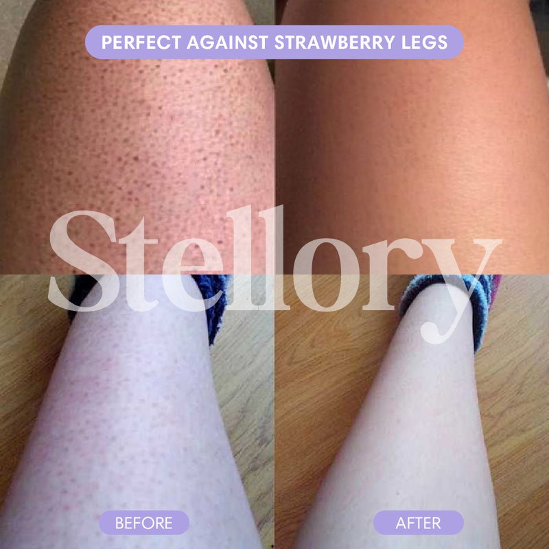 Stellory® Crystal Hair Eraser