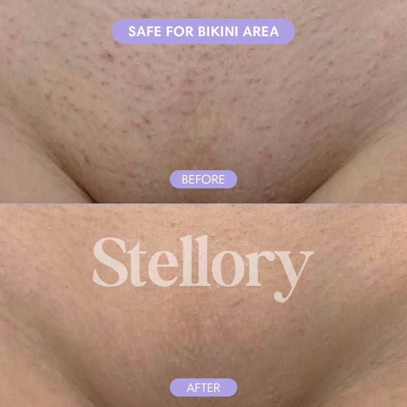 Stellory® Crystal Hair Eraser