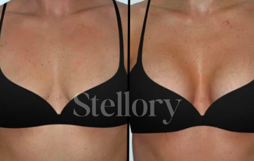 (VIP) Stellory® Sticky Inserts - Naturally Increase Cup Size