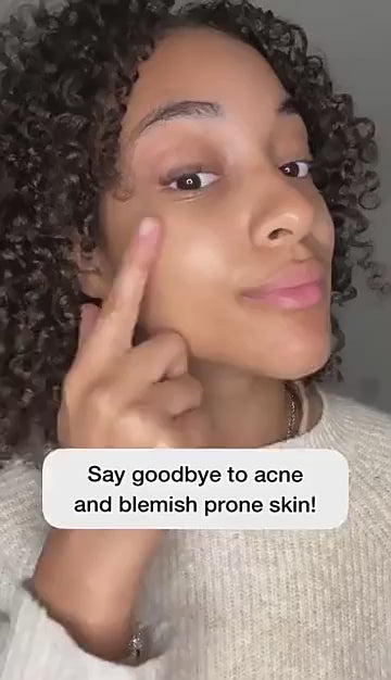 (VIP) Stellory® 3-Minute Acne Spot Treatment